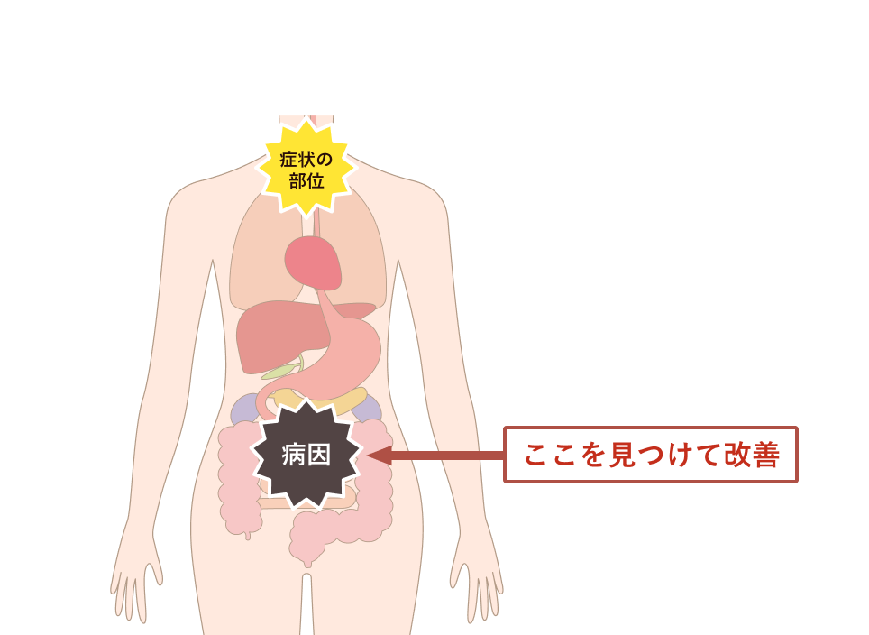 根本療法では病因を見つけて改善する図